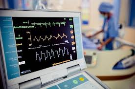 ElectroCardioGram (ECG)