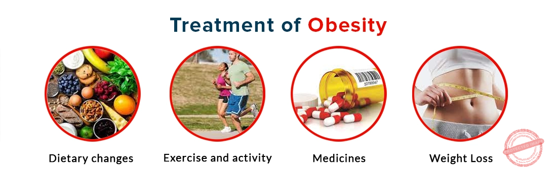 obesity treatment in anna nagar chennai